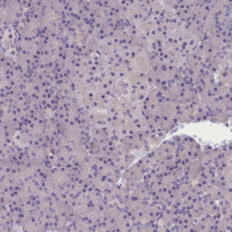 Staining of human pancreas shows low expression as expected.