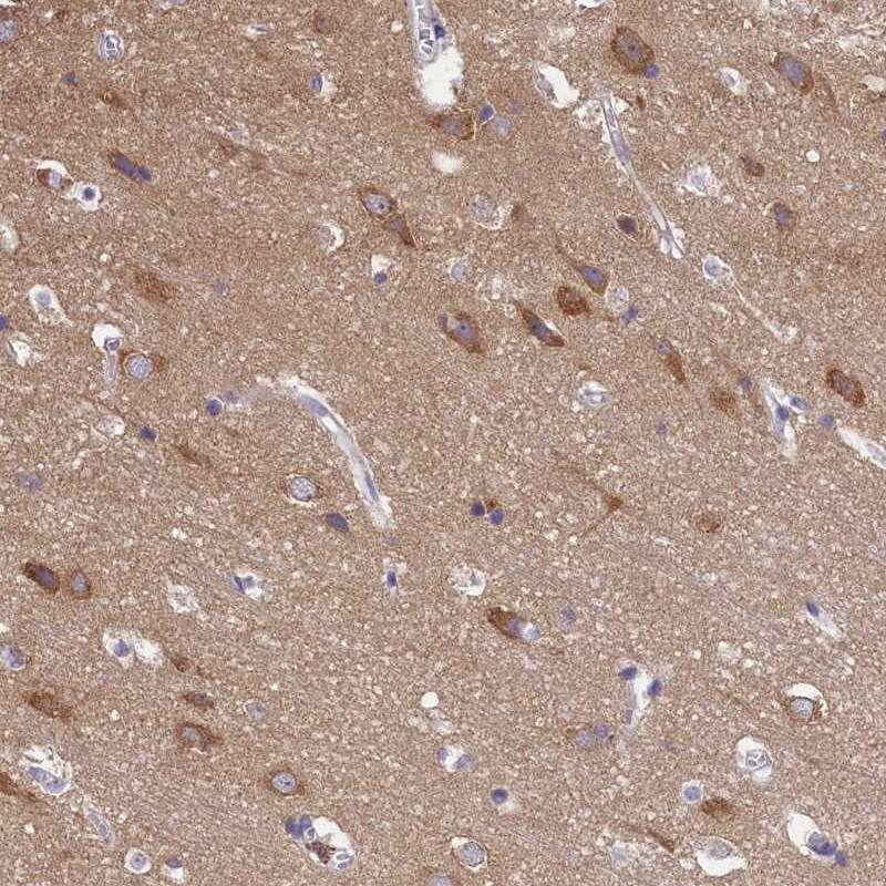Staining of human cerebral cortex shows high expression.