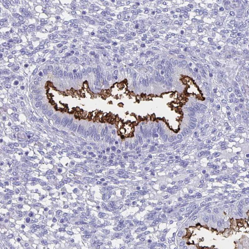 Immunohistochemistry-Paraffin SLC34A2 Antibody - BSA Free