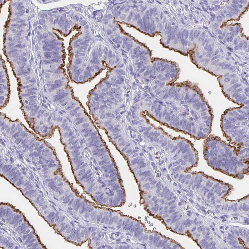 Immunohistochemistry-Paraffin SLC34A2 Antibody - BSA Free