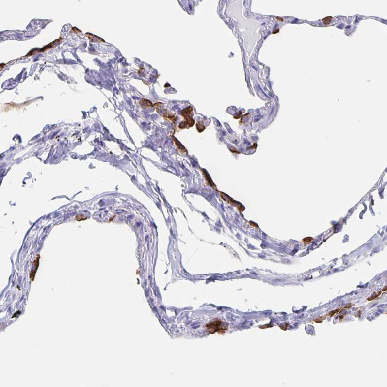 Immunohistochemistry-Paraffin SLC34A2 Antibody - BSA Free