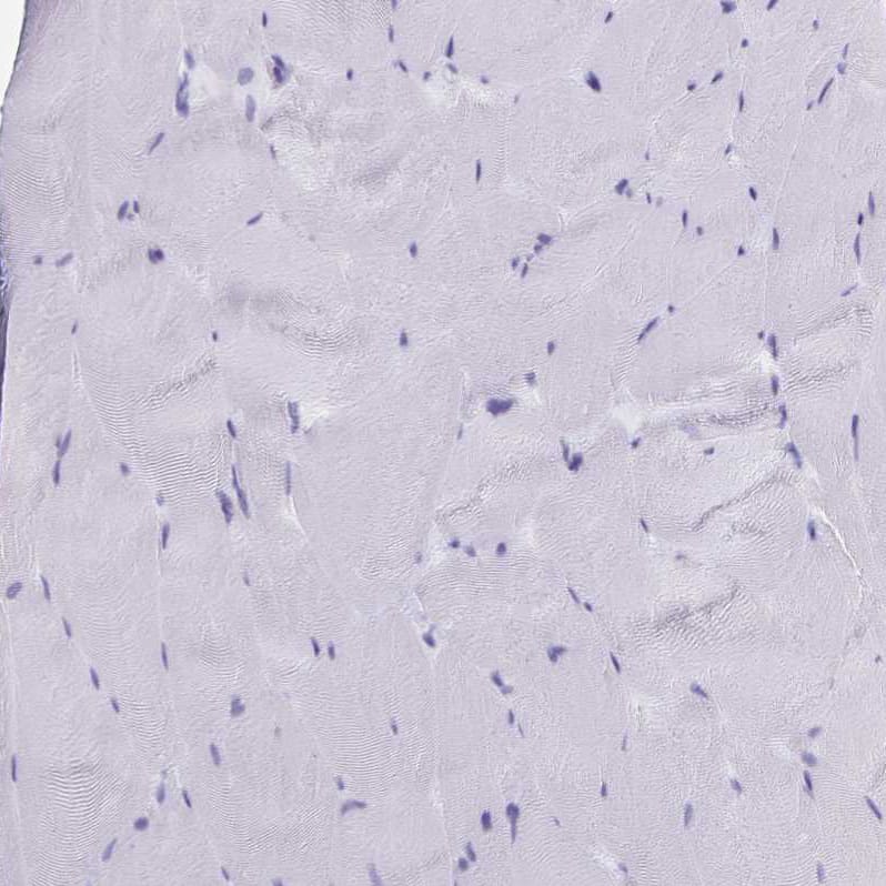 Staining of human skeletal muscle shows no positivity in myocytes as expected.
