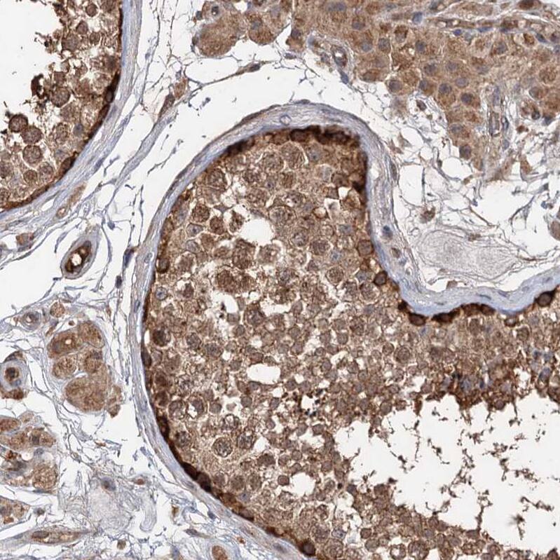 Staining of human testis shows moderate to strong cytoplasmic positivity in cells in seminiferous ducts.