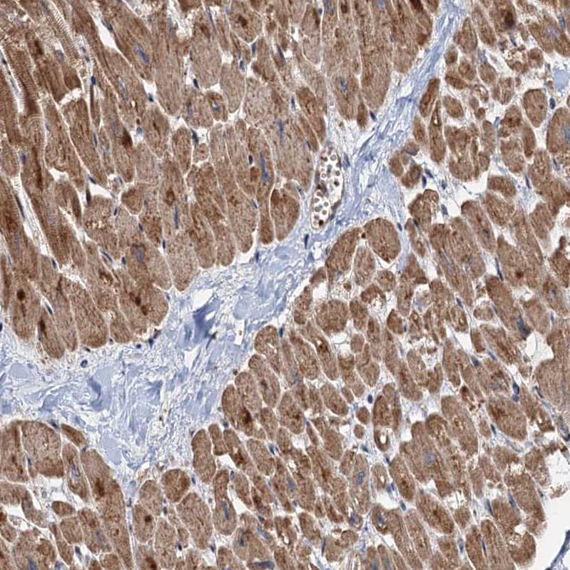 Staining of human heart muscle shows moderate to strong cytoplasmic positivity in cardiomyocytes.