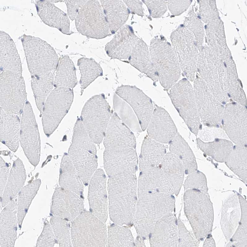 Immunohistochemistry-Paraffin MX2 Antibody - BSA Free