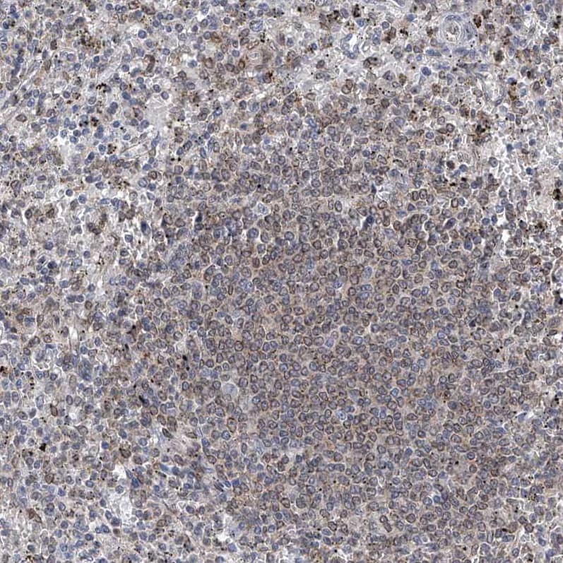 Immunohistochemistry-Paraffin MX2 Antibody - BSA Free