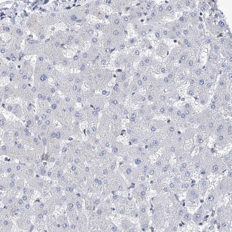 Immunohistochemistry-Paraffin MX2 Antibody - BSA Free