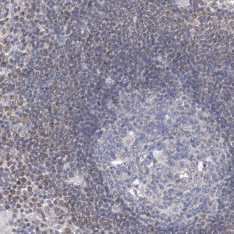 Immunohistochemistry-Paraffin MX2 Antibody - BSA Free