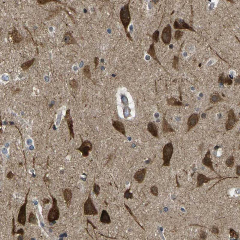 Immunohistochemistry-Paraffin KCTD10 Antibody - BSA Free