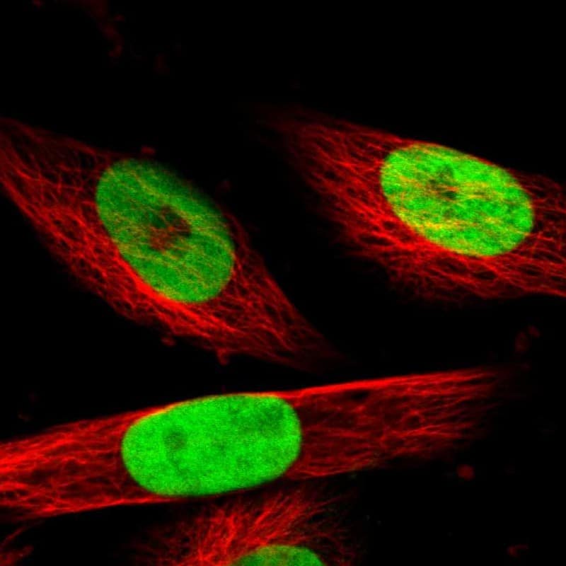 Staining of human cell line U-251 MG shows localization to nucleoplasm.
