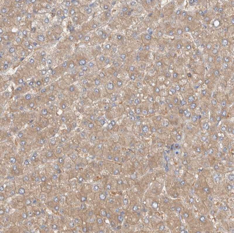 Staining of human liver shows moderate cytoplasmic positivity in hepatocytes.