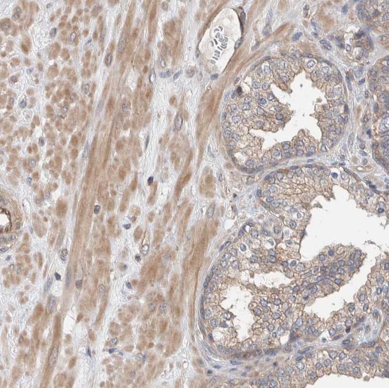 Staining of human prostate shows weak to moderate cytoplasmic positivity in smooth muscle cells.