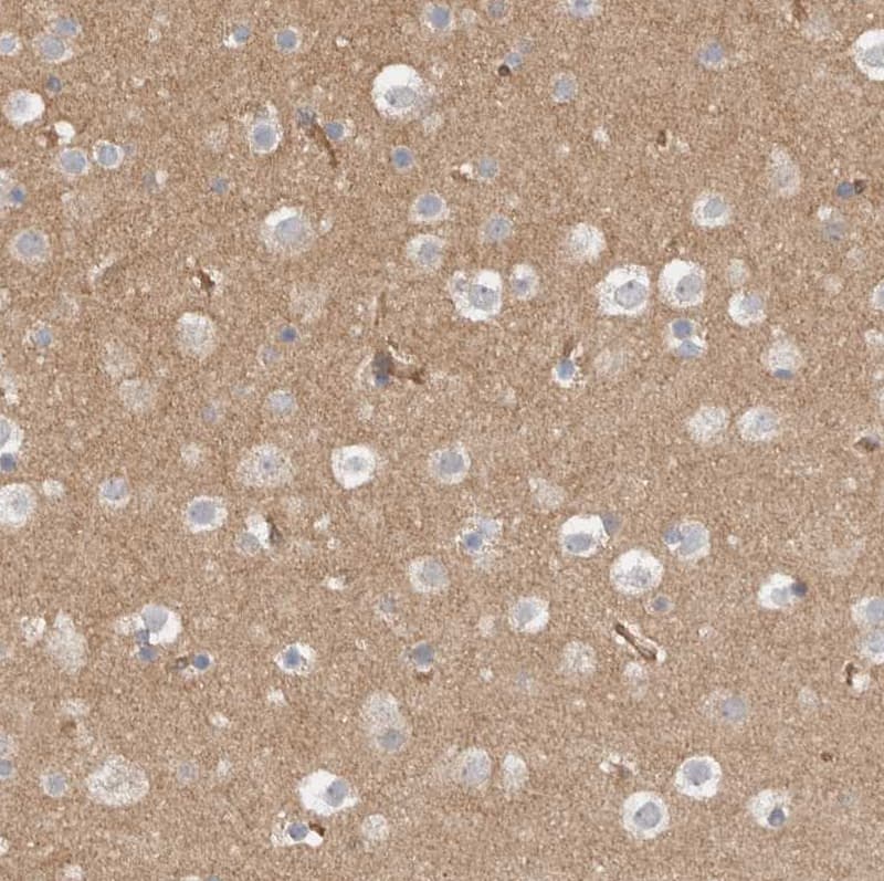 Staining of human cerebral cortex shows moderate cytoplasmic positivity in neuropil.