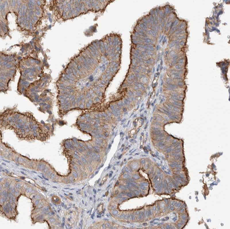 Staining of human Fallopian tube shows moderate positivity in apical membrane in glandular cells.