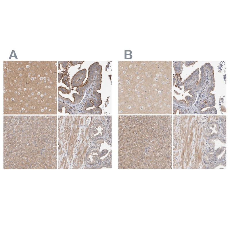 Staining of human cerebral cortex, fallopian tube, liver and prostate HPA022901 (A) shows similar protein distribution across tissues to independent antibody HPA022034 (B).