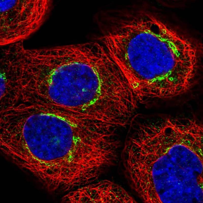 Staining of human cell line A-431 shows localization to the Golgi apparatus & vesicles.
