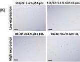 GDF‐15 expression is modulated by ROS‐induced p53 activation. (A) Relative release of GDF‐15 at 7 days and 14 days after ex vivo cartilage trauma of untreated or NAC‐treated explants. (B) Gene expression of GDF15 and (C, D) detection of intracellular ROS levels by DCFDA assay in isolated hAC upon H2O2 exposure for 48 h. (E) Release of GDF‐15 by H2O2‐treated hAC with or without treatment of NAC. (F) Representative images of IF staining of p53 in H2O2‐treated hAC. (G) Correlation analysis between CTCF values of p53 staining and GDF‐15 concentrations of unstimulated or H2O2‐treated hAC. (H) Quantification of posttraumatic p53 activation (detected by means of IHC) and effects of antioxidative therapy by NAC at 7 days after ex vivo cartilage trauma. Gene expression analysis of GDF‐15 in hAC after stimulation with (I) the MDM2 antagonist (p53 inducing) Nutlin‐3a and (J) the inhibitor of p53 transcription activity, Pifithrin‐ alpha  or Pifithrin‐μ. (K) Representative images of IHC staining against p53 and GDF‐15 in human cartilage and (L) corresponding correlation analysis. The white bars in (C) and (F) represent 100 um. The black bars in (K) represent 200 um. Image collected and cropped by CiteAb from the following open publication (//pubmed.ncbi.nlm.nih.gov/41287825), licensed under a CC-BY license. Not internally tested by Novus Biologicals.