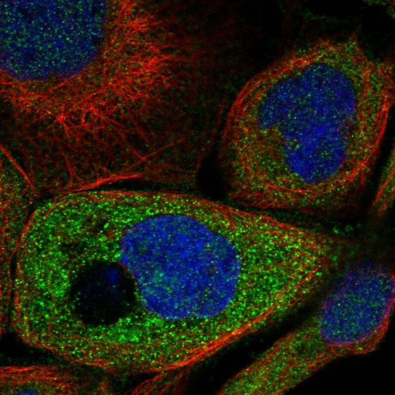 Staining of human cell line A-431 shows localization to nucleoplasm & cytosol.