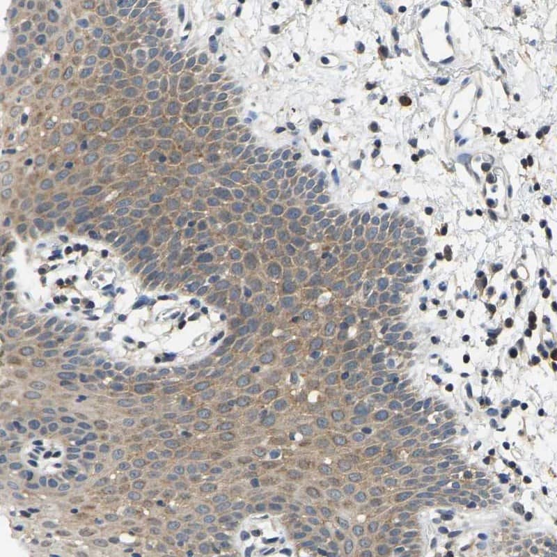 Staining of human oral mucosa shows cytoplasmic positivity in squamous epithelial cells.