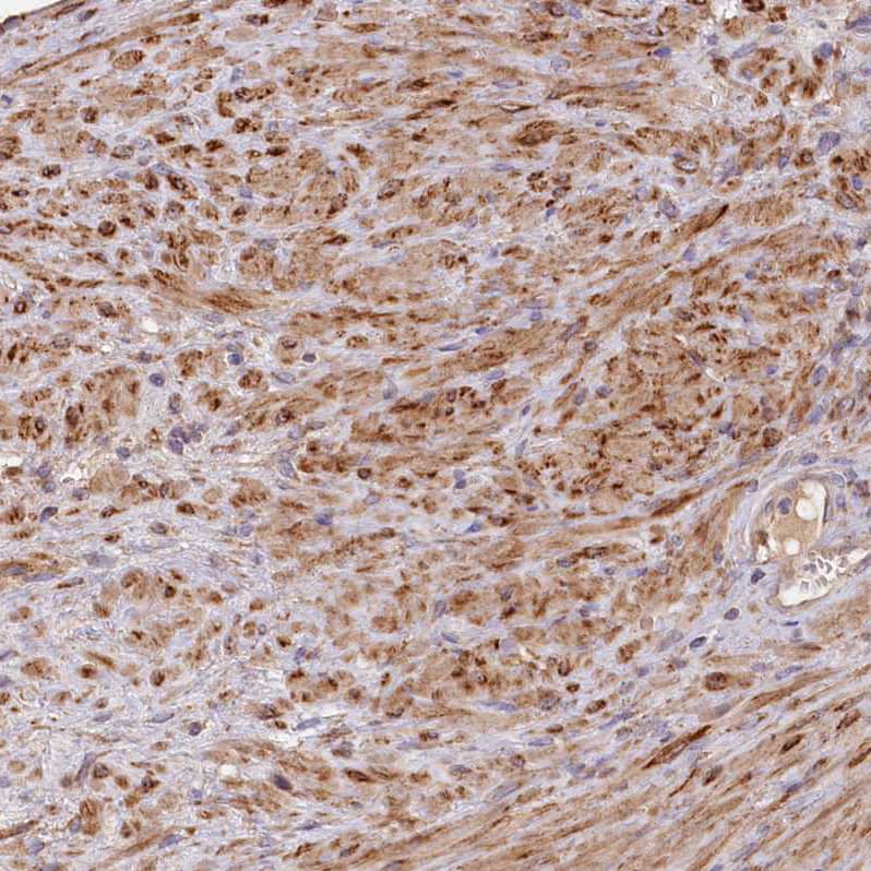 Immunohistochemistry-Paraffin FUNDC1 Antibody - BSA Free