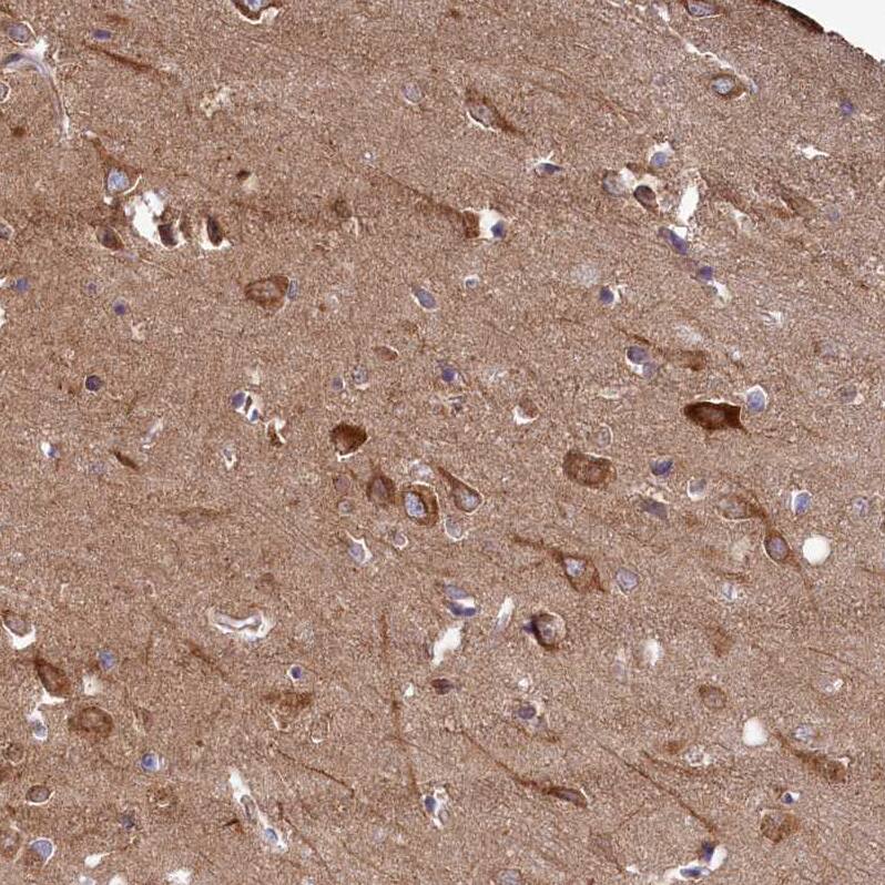Immunohistochemistry-Paraffin FUNDC1 Antibody - BSA Free