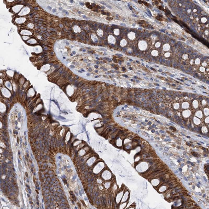 Immunohistochemistry-Paraffin LNX2 Antibody - BSA Free