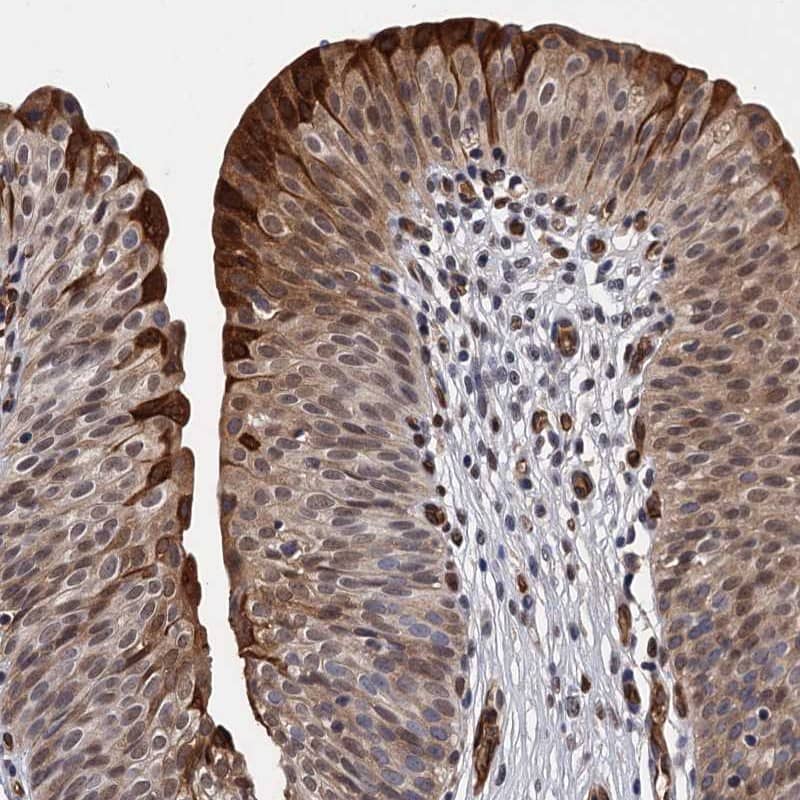 Staining of human urinary bladder shows strong cytoplasmic and nuclear positivity in urothelial cells.