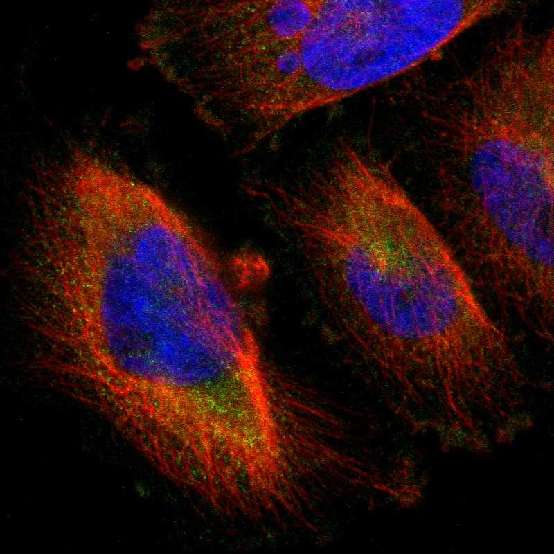 Staining of human cell line U-251 MG shows localization to cytosol.