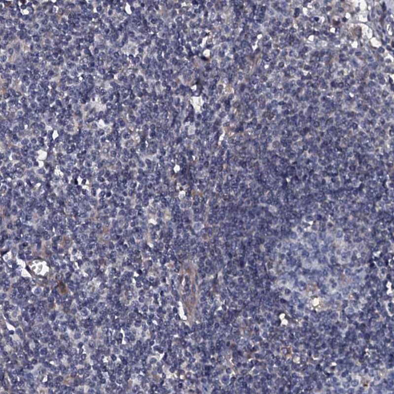 Staining of human lymph node shows no positivity in non-germinal center cells and germinal center cells as expected.