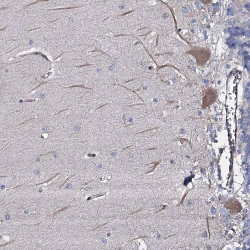 Staining of human cerebellum shows moderate cytoplasmic-membranous positivity in Purkinje cells.