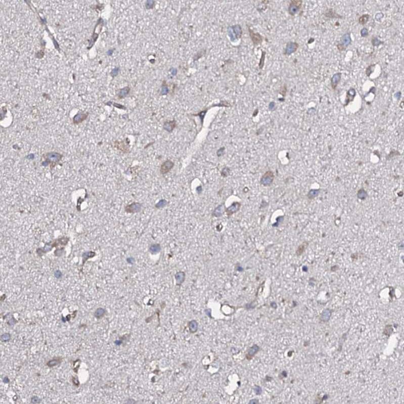 Staining of human cerebral cortex shows weak cytoplasmic-membranous positivity in neurons.