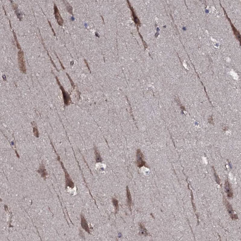 Staining of human hippocampus shows moderate cytoplasmic-membranous positivity in neurons.