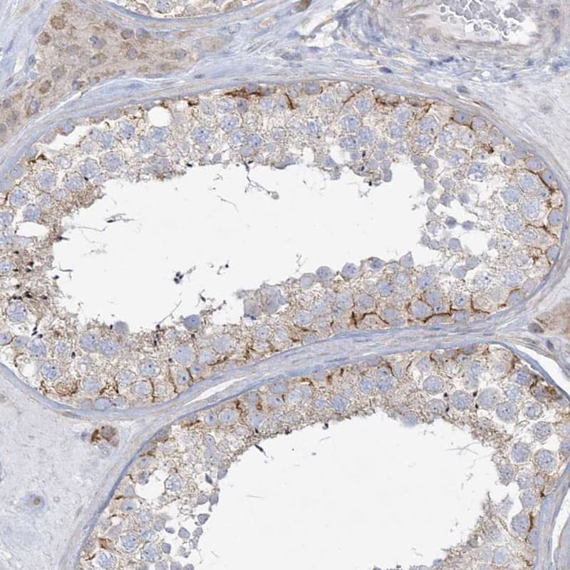 Staining of human testis shows strong membranous positivity in cells in seminiferous ducts.