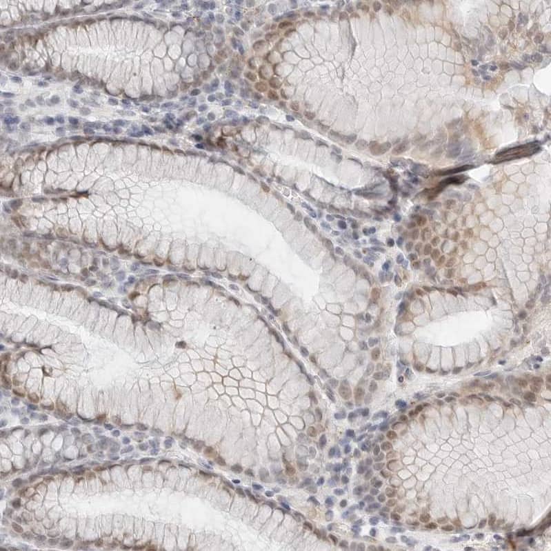 Immunohistochemistry-Paraffin TSEN2 Antibody - BSA Free