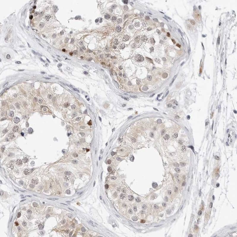 Immunohistochemistry-Paraffin TSEN2 Antibody - BSA Free