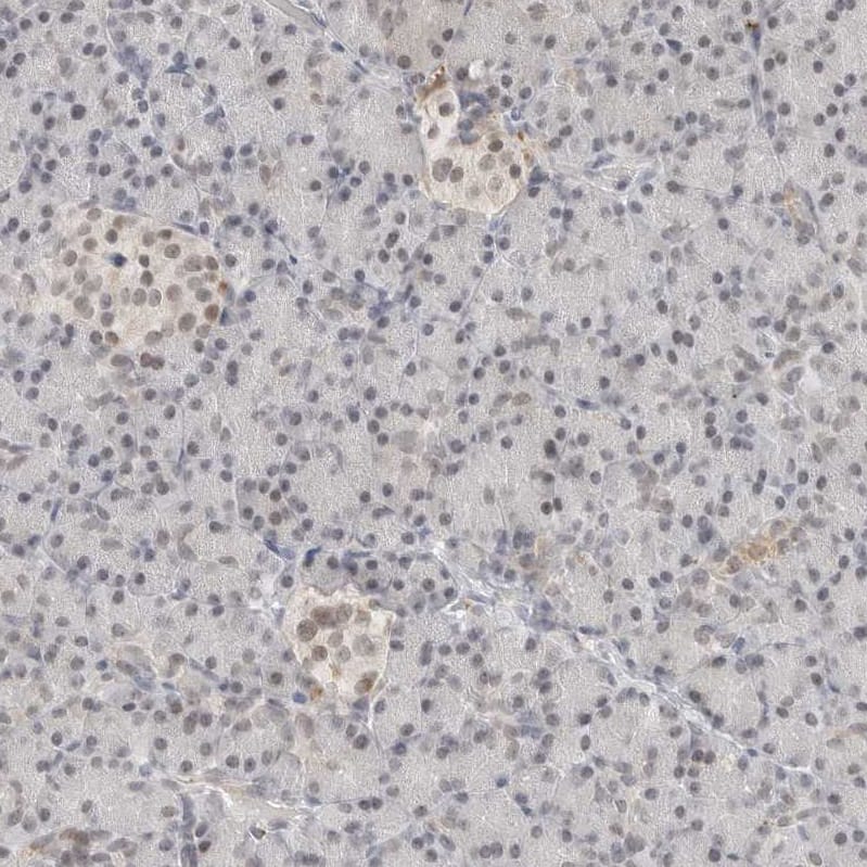 Immunohistochemistry-Paraffin TSEN2 Antibody - BSA Free