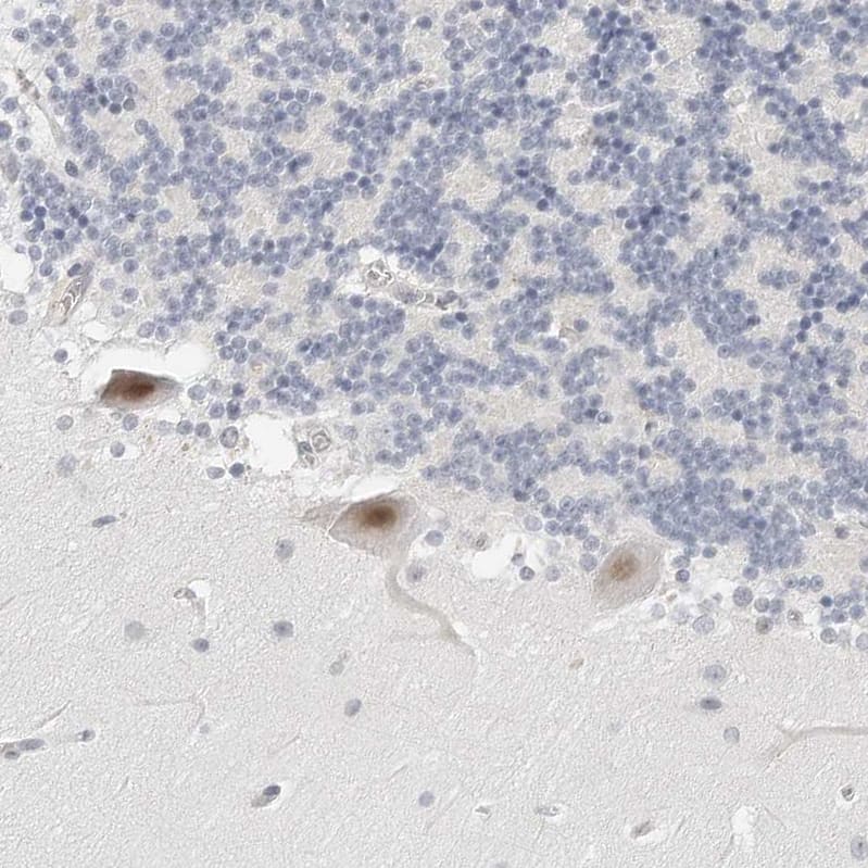 Immunohistochemistry-Paraffin TSEN2 Antibody - BSA Free