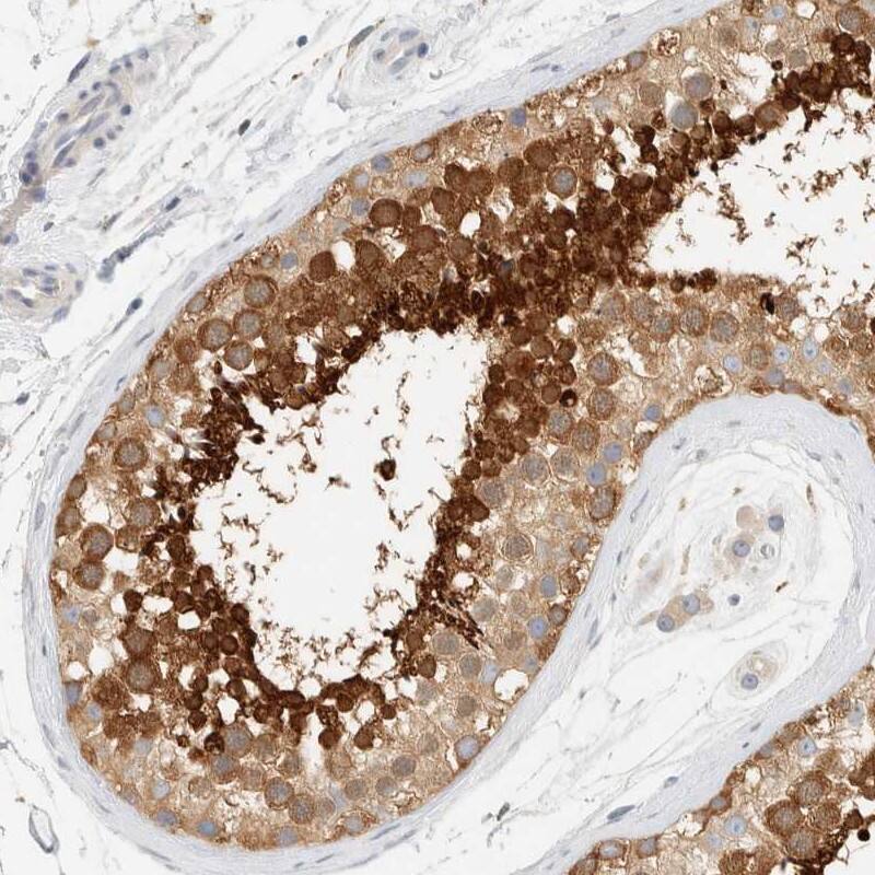 Immunohistochemistry-Paraffin AARSD1 Antibody - BSA Free