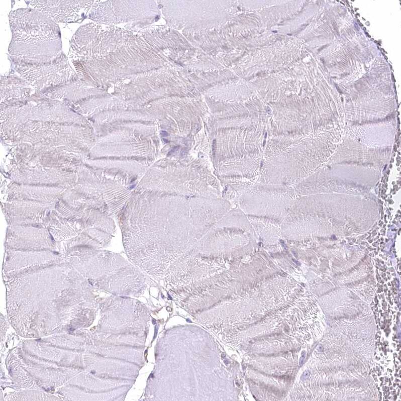 Immunohistochemistry-Paraffin LRRC34 Antibody - BSA Free