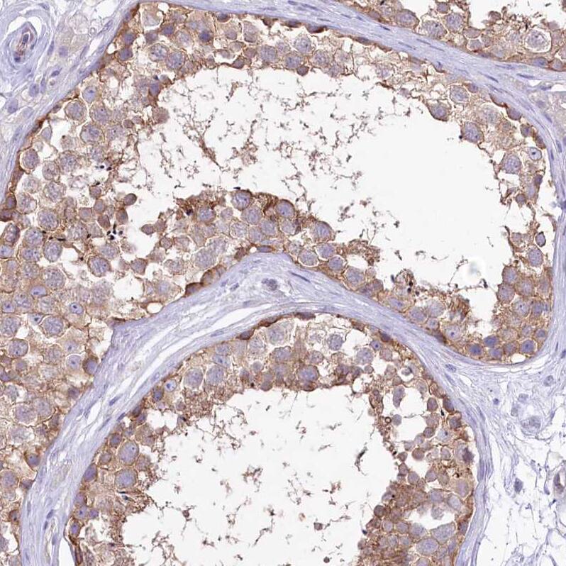 Immunohistochemistry-Paraffin LRRC34 Antibody - BSA Free