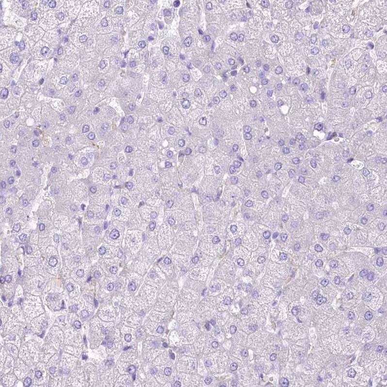 Immunohistochemistry-Paraffin LRRC34 Antibody - BSA Free