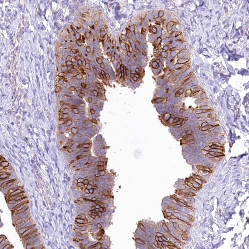 Immunohistochemistry-Paraffin LRRC34 Antibody - BSA Free