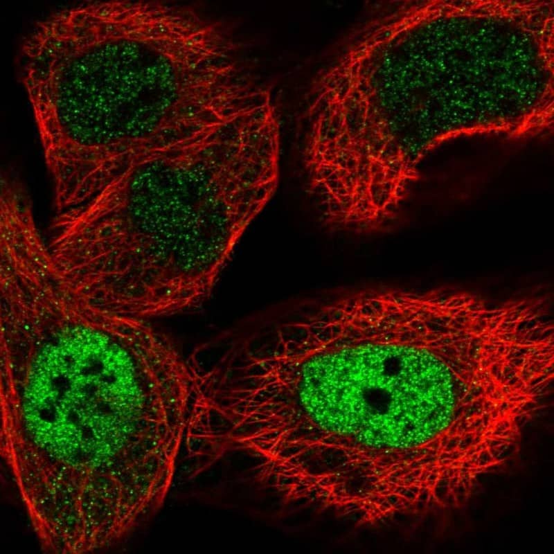 Staining of human cell line A-431 shows localization to nucleoplasm.