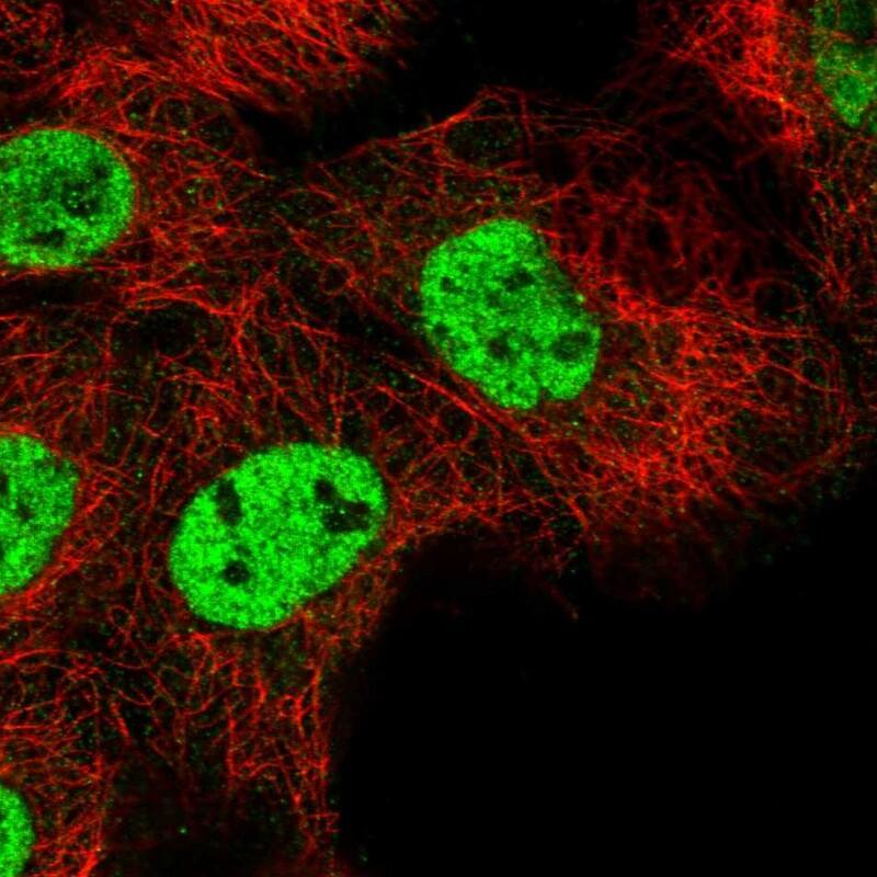 Immunocytochemistry/ Immunofluorescence RNF26 Antibody - BSA Free