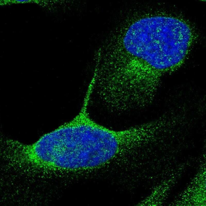 Staining of human cell line U-2 OS shows localization to vesicles.