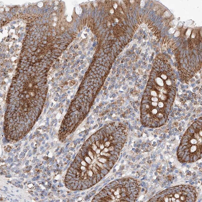 Immunohistochemistry-Paraffin KTI12 Antibody - BSA Free