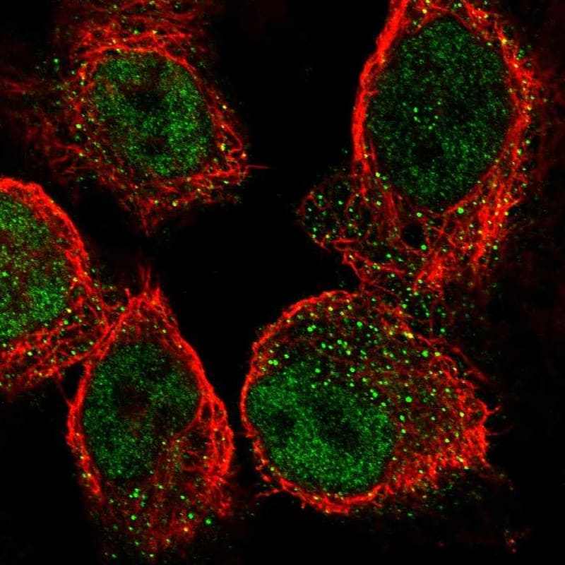 Staining of human cell line A-431 shows localization to nucleoplasm & vesicles.