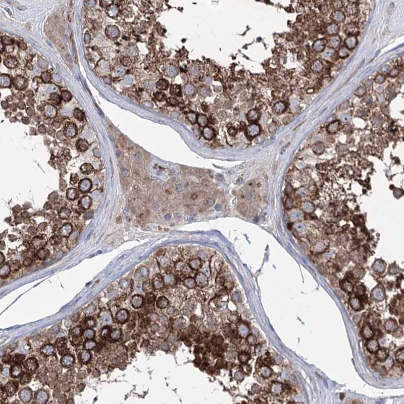 Staining of human testis shows cytoplasmic positivity in cells in seminiferous ducts and Leydig cells.