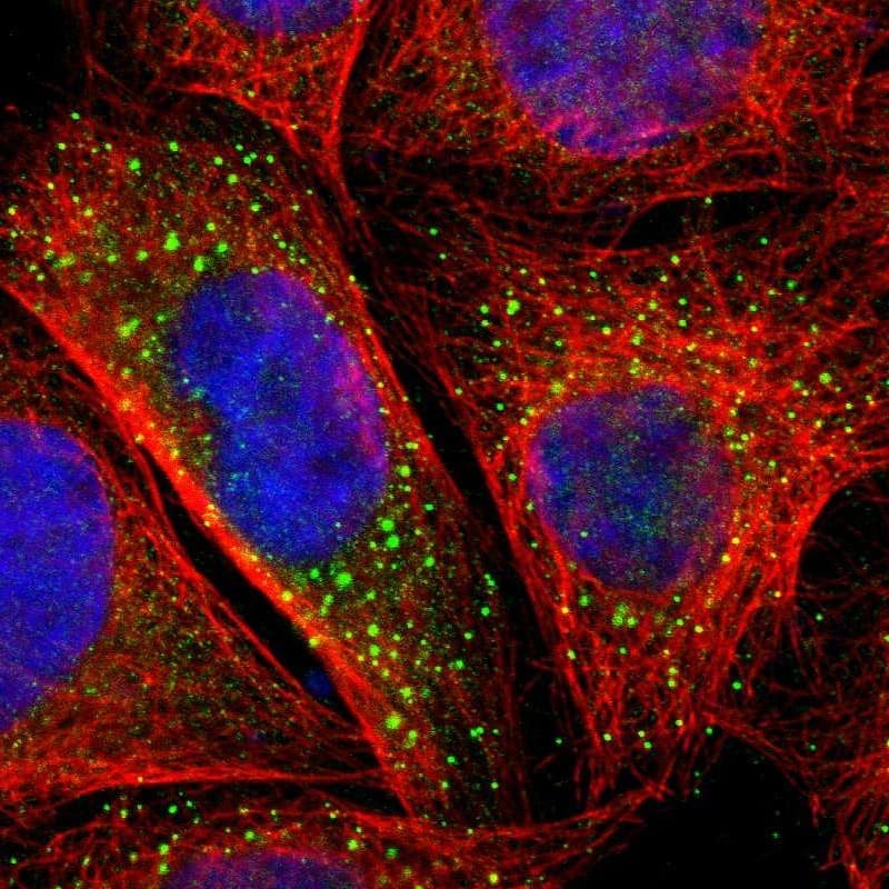 Staining of human cell line A-431 shows localization to vesicles.