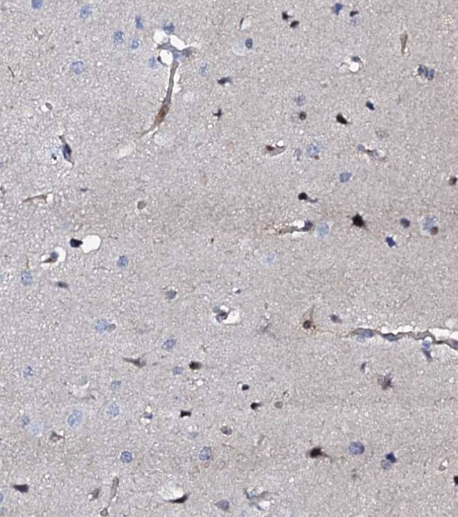 Staining of human cerebral cortex shows strong nuclear positivity in neurons and weak cytoplasmic positivity in neuropil.